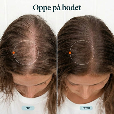 Koreansk hårserum som vekker en tørr hodebunn til live igjen