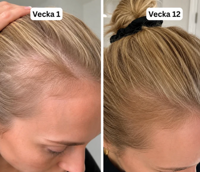 Koreansk hårserum som vekker en tørr hodebunn til live igjen